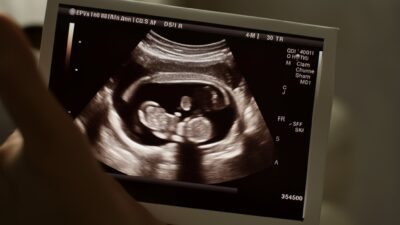 Hrvatska glumica Martina Stjepanović Meter očekuje prinovu: “Beba stiže na proljeće”