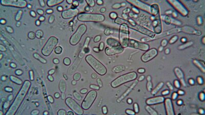 Legionela potvrđena u koprivničkoj osnovnoj školi: Pokrenuta dezinfekcija vodovodnog sustava