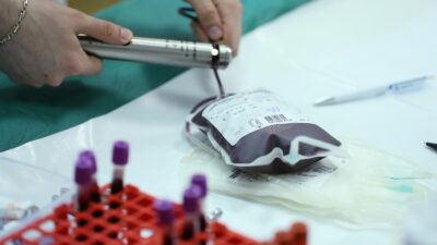 Zdravstveni rizici povezani s krvnim grupama: Što vaša krvna grupa govori o vašem zdravlju?