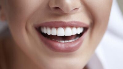 Vodeća stomatologinja upozorava: Ova pića najviše ugrožavaju zdravlje vaših zuba